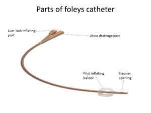 foleys catheter