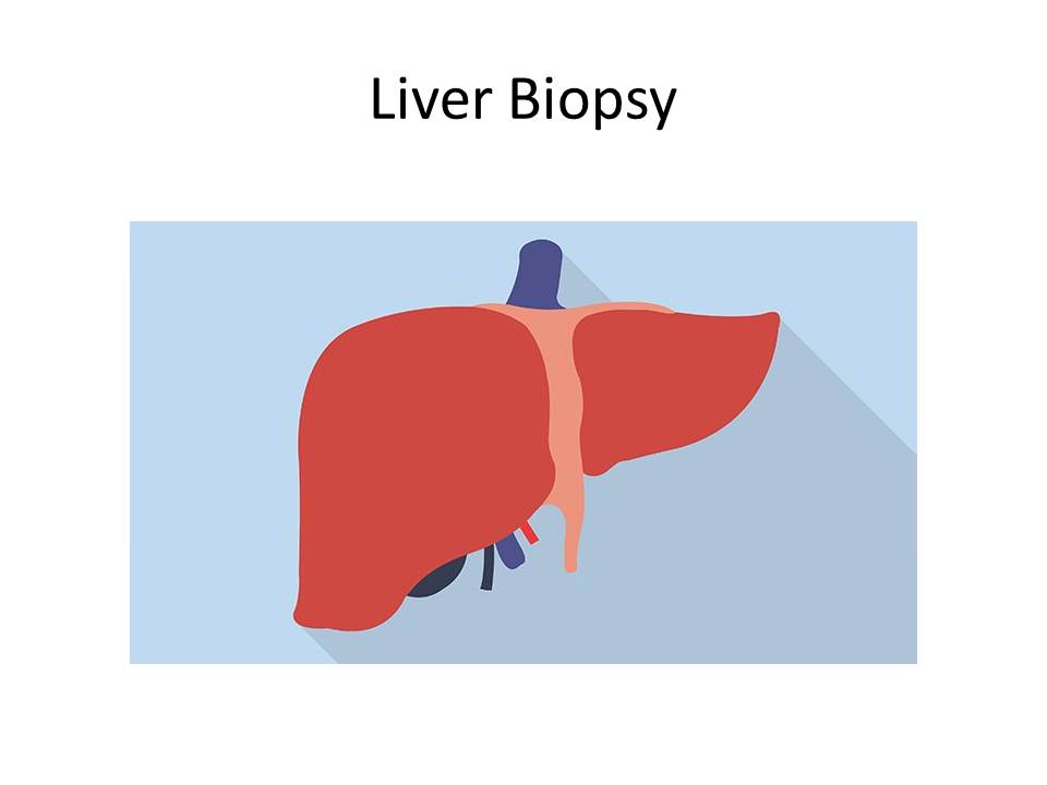 liver biopsy