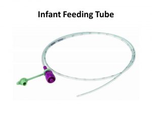 infant feeding tube
