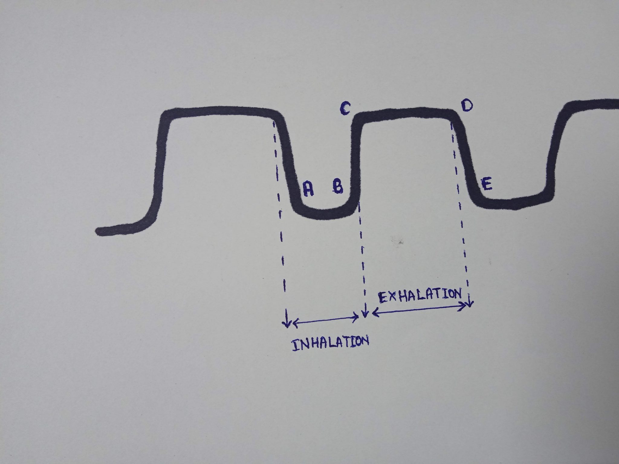 end tidal capnography