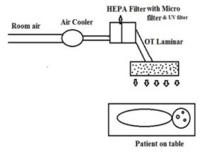 Laminar air flow in ot