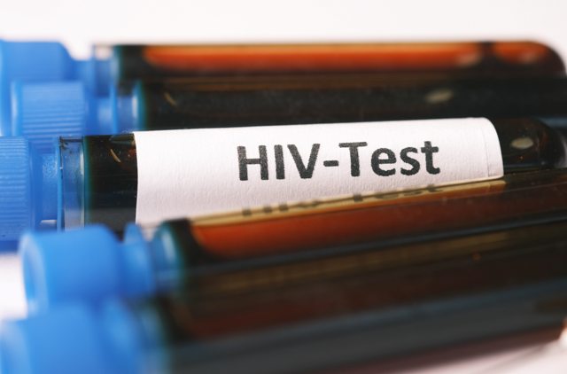 human immunodeficiency virus